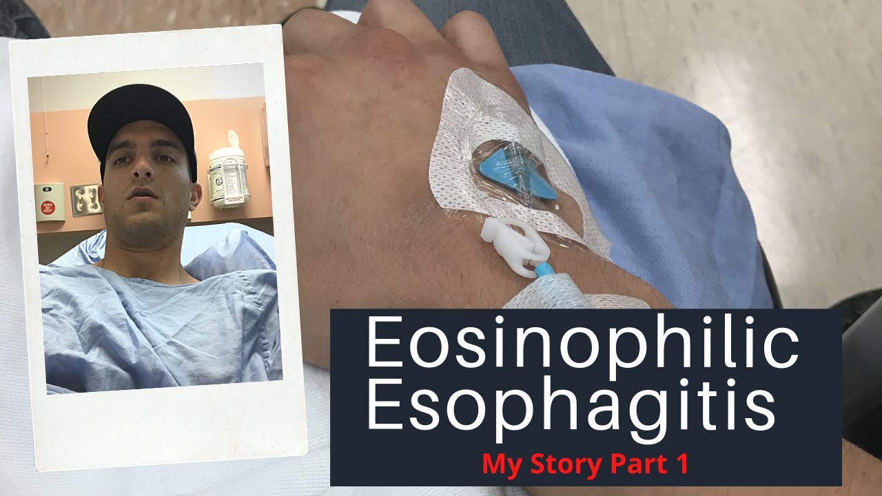 Eosinophilic Esophagitis (EoE) | My Story Part 1|