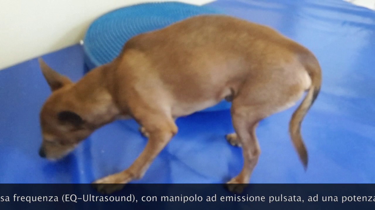 Sublussazione scapolo omerale