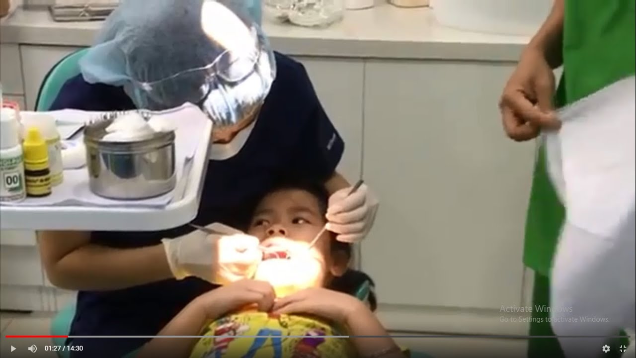 TRÁM RĂNG SỮA KHÔNG ĐAU-