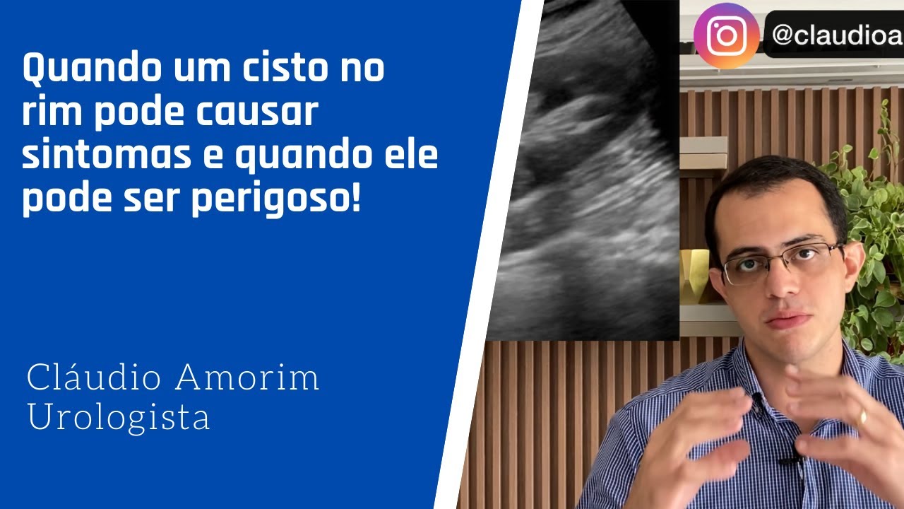 Quando um cisto no rim pode causar sintomas e quando ele pode ser perigoso!