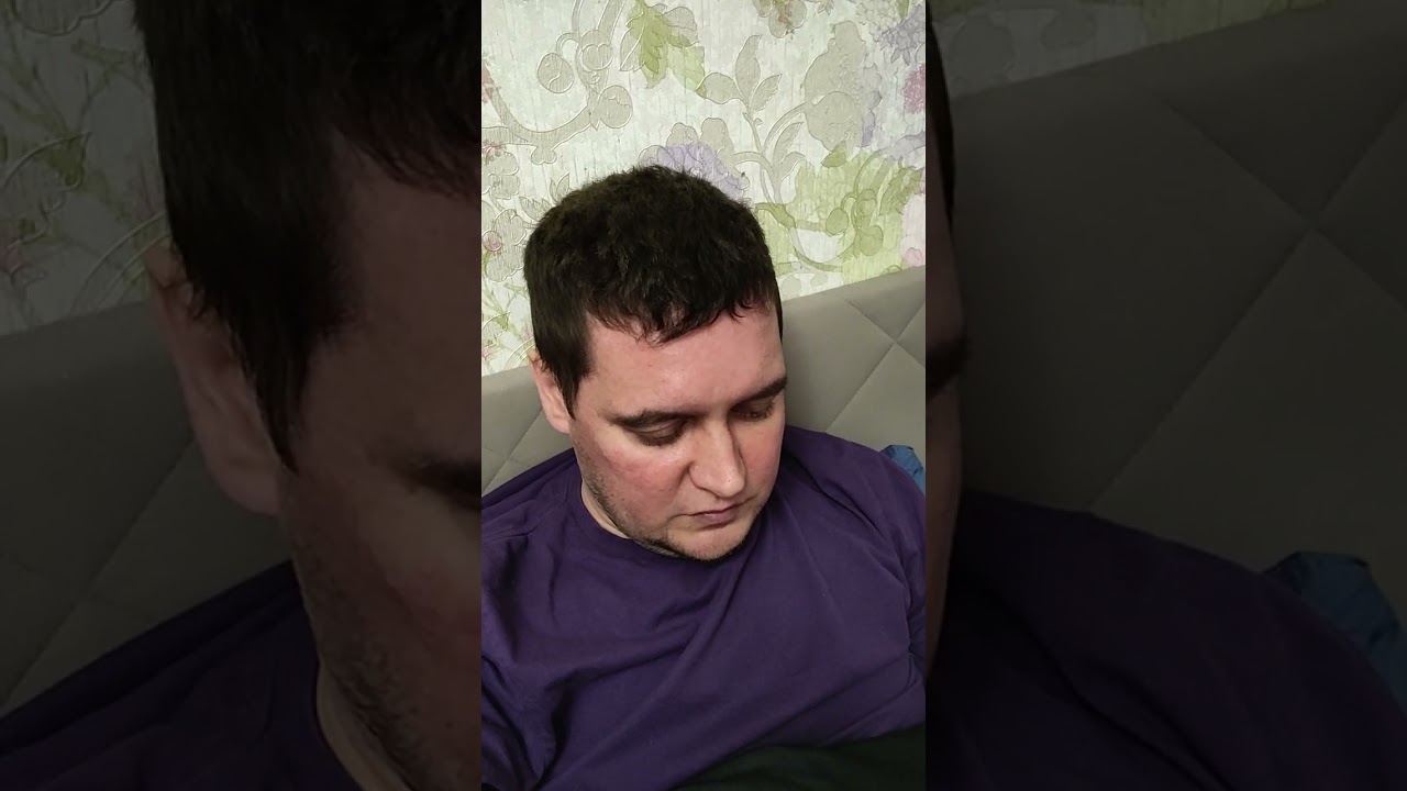 Депрессия🥺Обезболы🥹Хочется жить! Поездка в Москву будет после химиотерапии😌