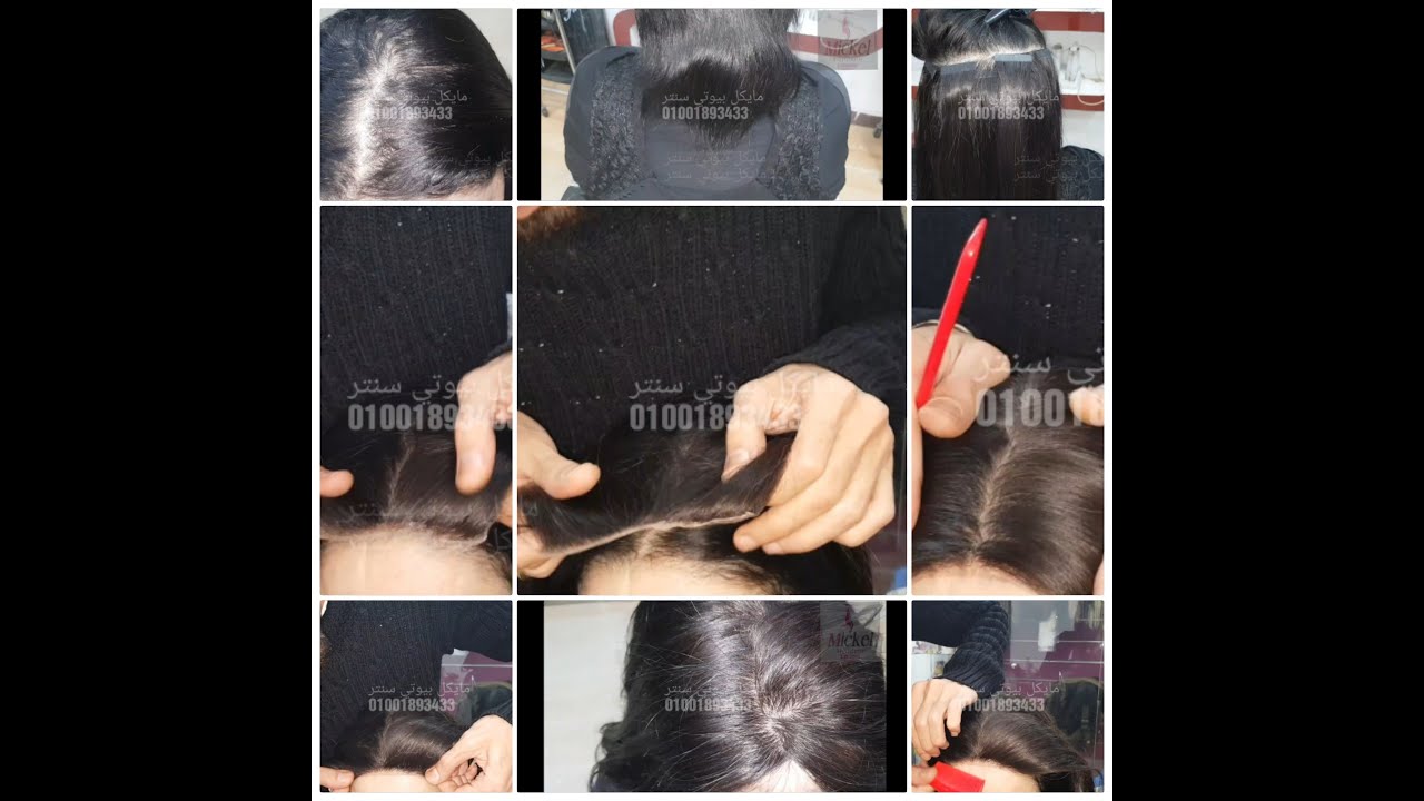 تركيب شعر طبيعي دبل فيس وقصة جلد فرنسية مايكل بيوتي سنتر   01001893433