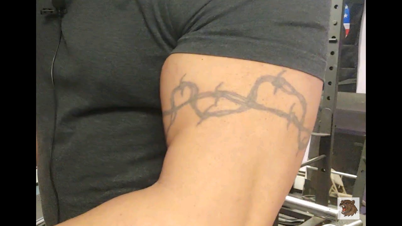 Partial Biceps Tendon Tear No Surgery