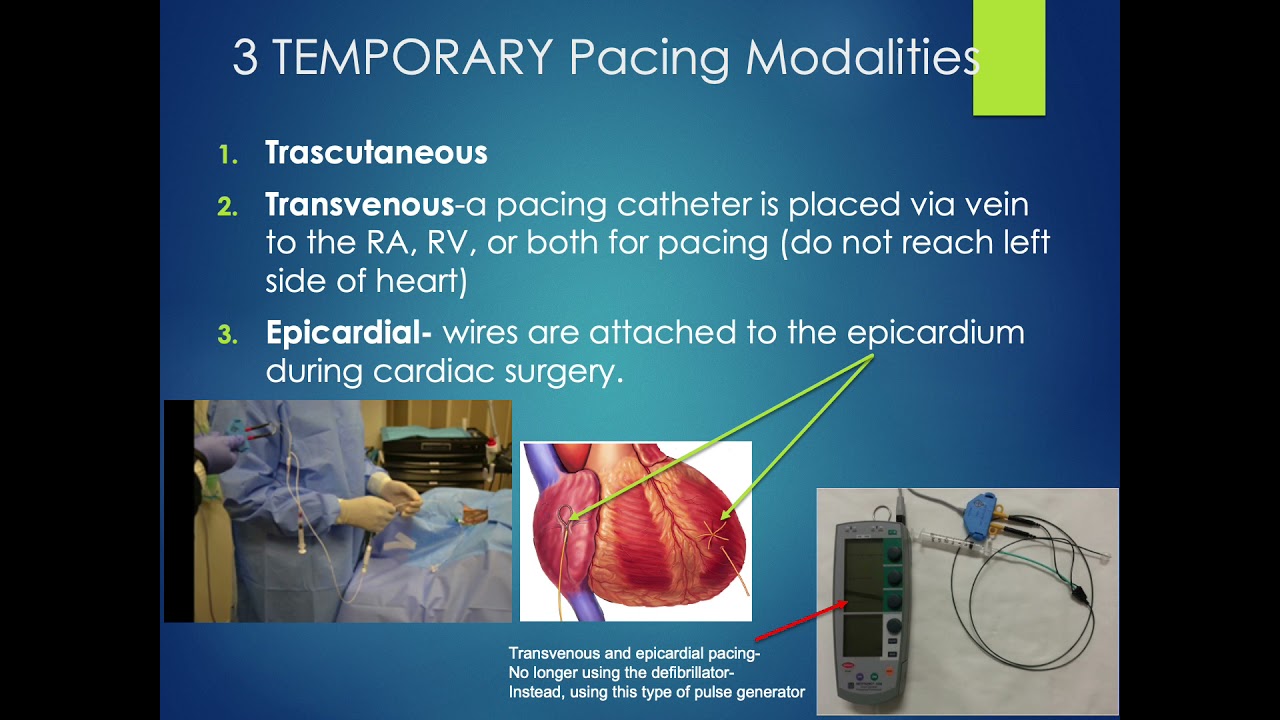 Introduction to Pacemaking Principles
