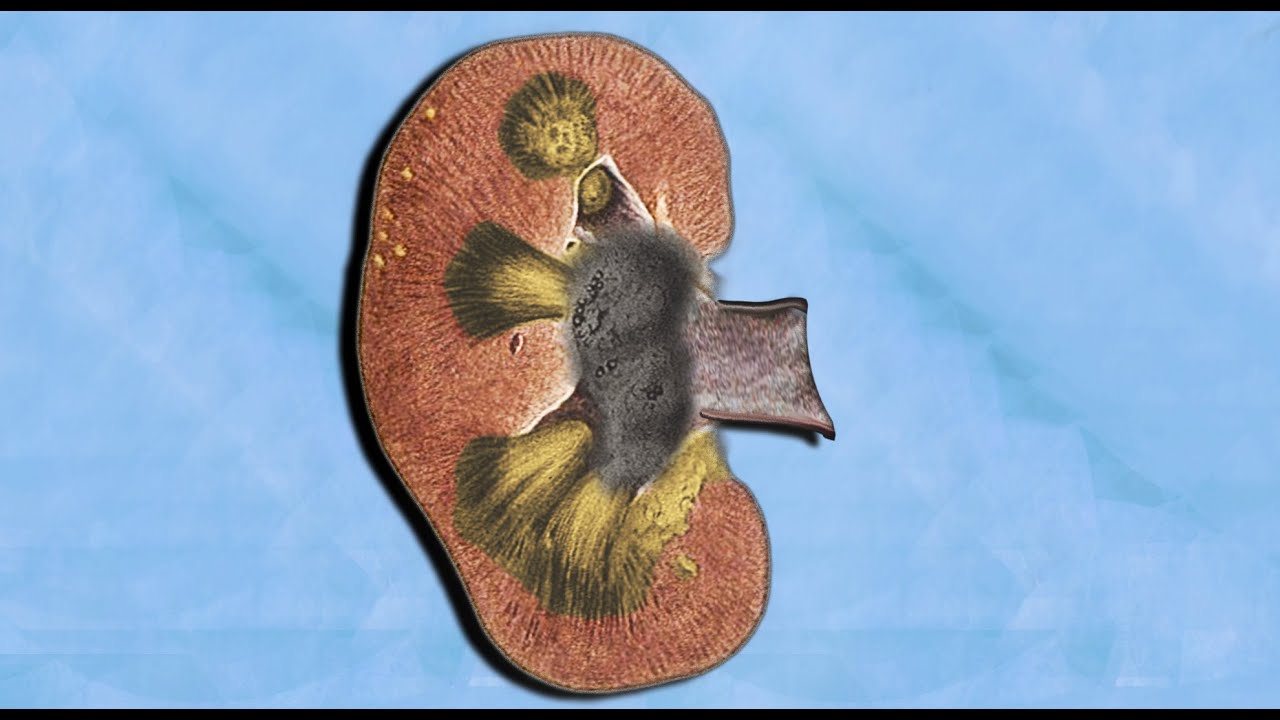 A Student Drank 2 Gallons Coffee. This Is What Happened To His Kidneys.