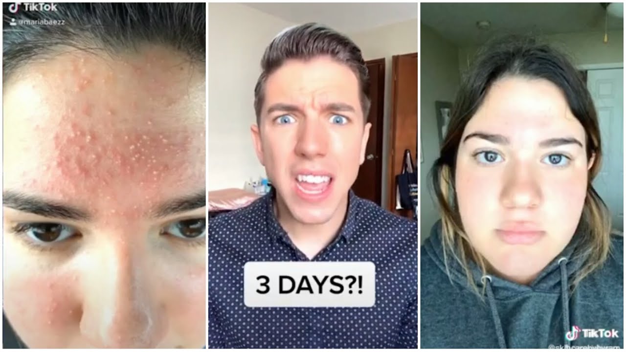 Skincare By Hyram Tik Tok compilation