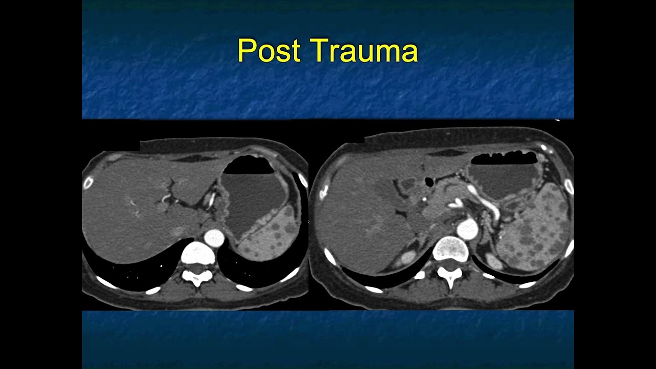 You Make the Call! Freestyle Radiology Quiz #16