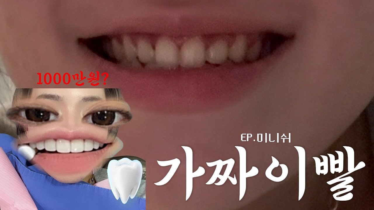 05년생 예비신부가 말아주는 미니쉬 Q&A 🦷💍👰🏼&zwj;♀️