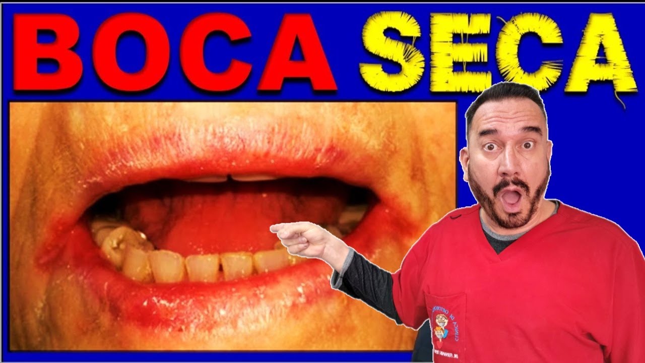 СУХОЙ РОТ 🔥 ДИАГНОСТИКА КСЕРОСТОМИИ И ЛЕЧЕНИЯ ✅