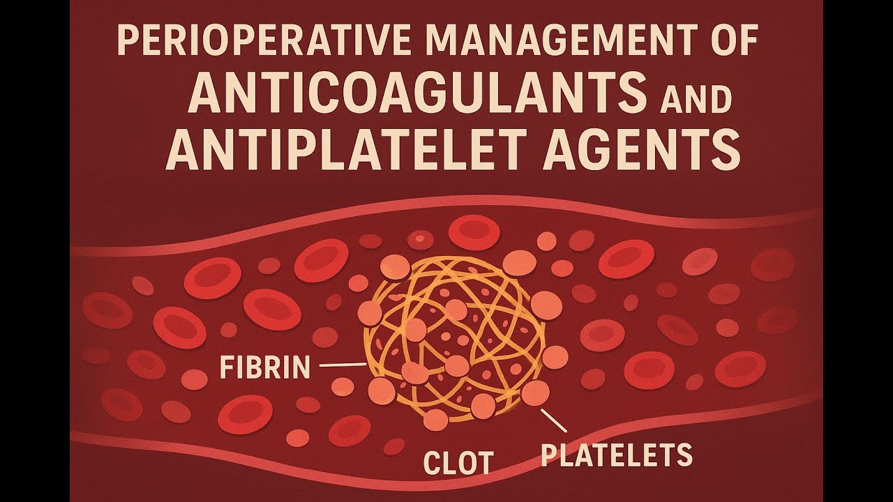 01👉 Perioperative Management of Anticoagulants and Antiplatelet Agents (2025)