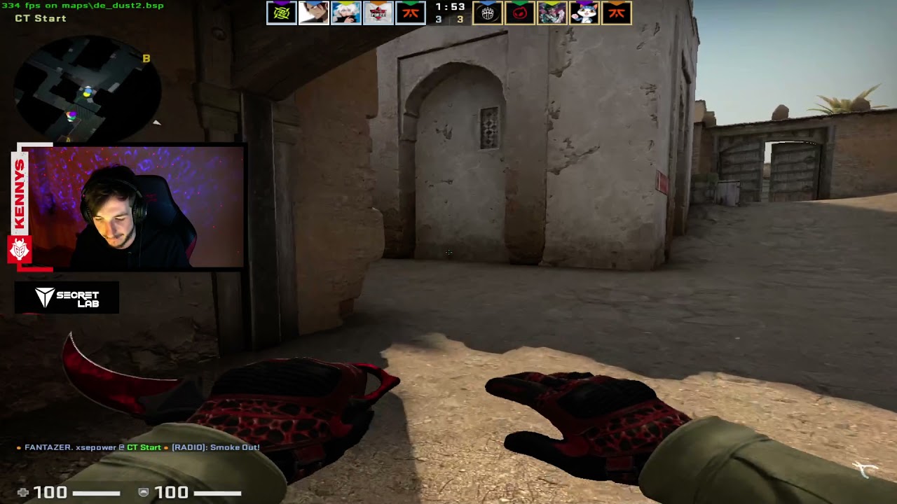 kennyS plays FPL w/ Plopski nealan Brollan against XANTARES woxic xfl0ud JW - Faceit Pro League