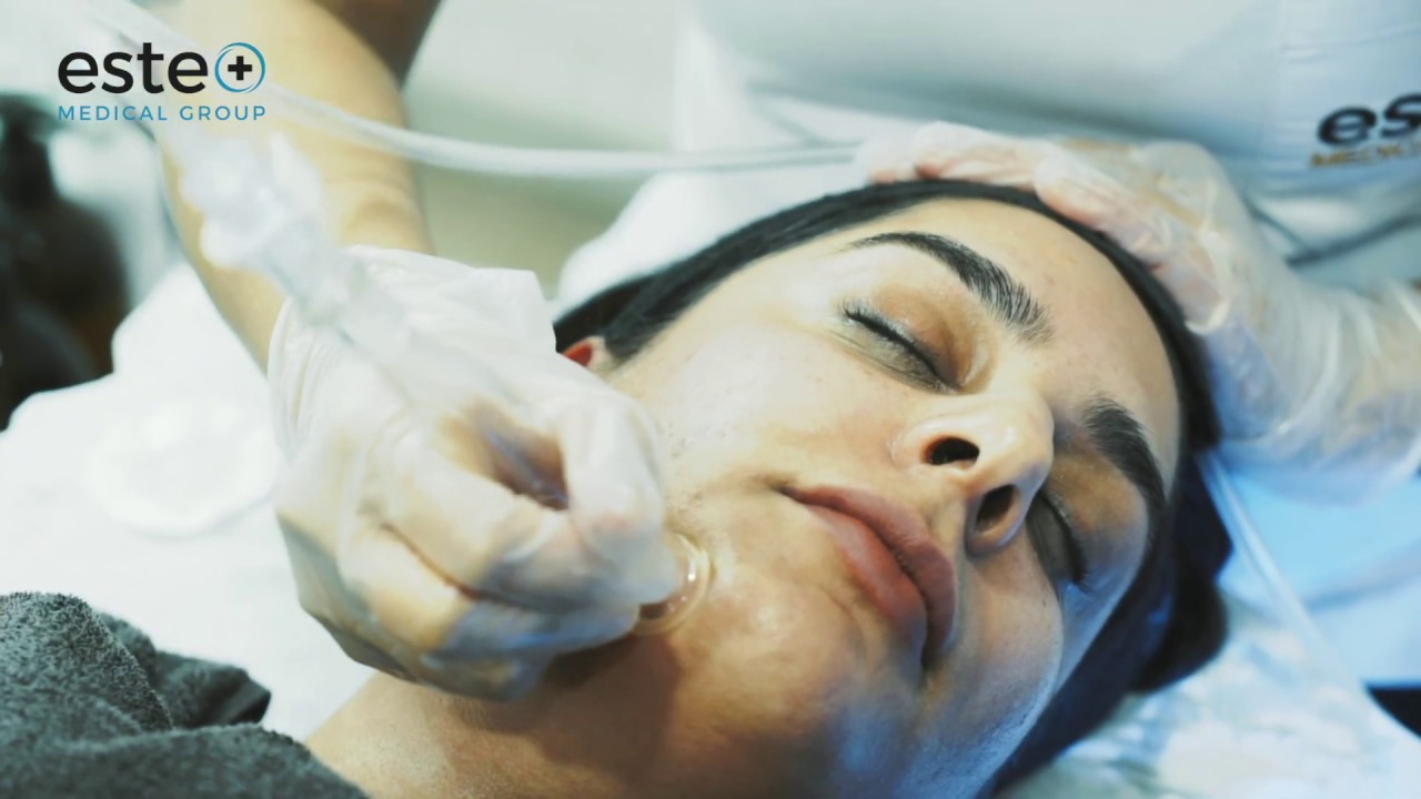 What Is a Hydrafacial treatment? | Este Medical Group | Skincare Tips