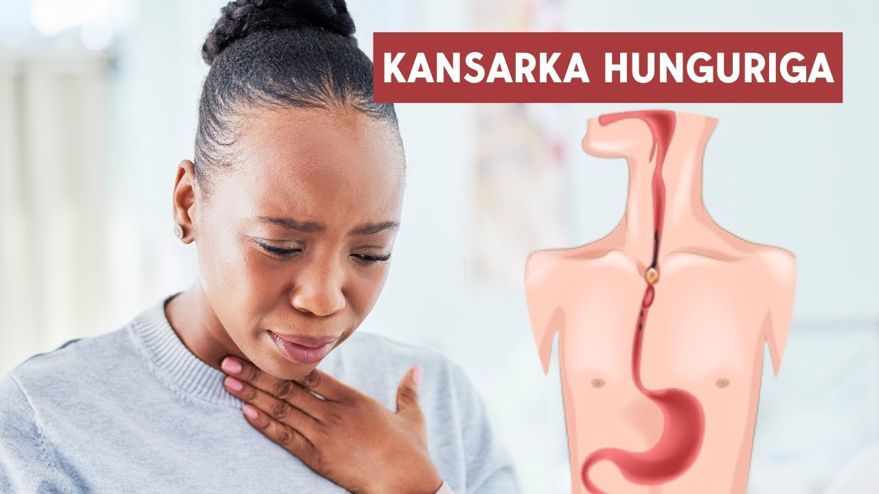 Calaamadaha Kansarka Dhuunta Ama Cunaha, Sababaha Ku Badiyay Soomaalida Iyo Hababka Dawayntiisa