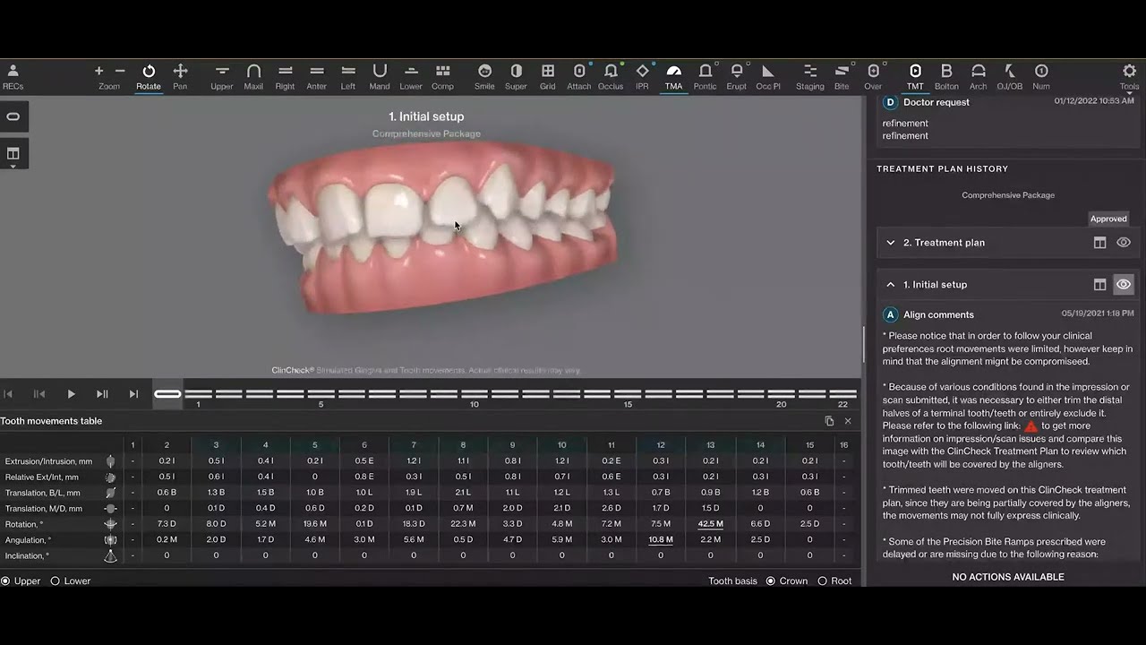 Аппарат для коррекции движений Carriere Motion - Invisalign