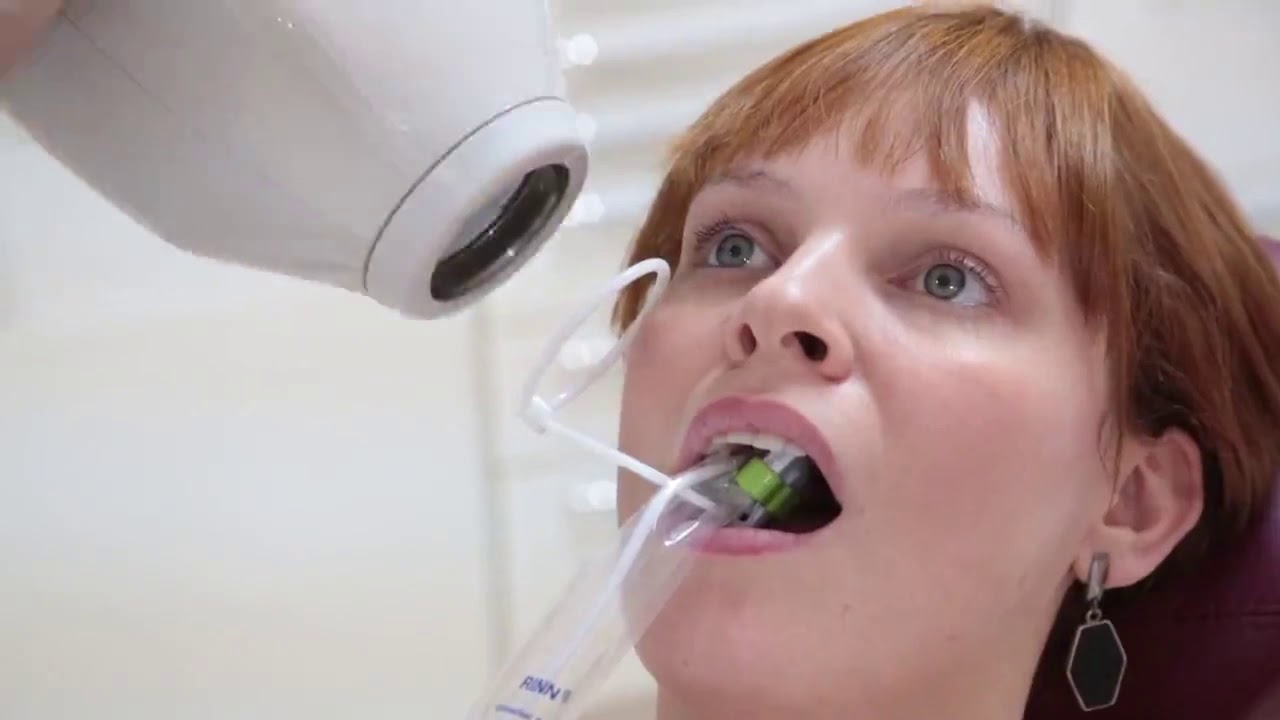 Sensor Radiovisiógrafo Gnatus Eagle New IDA - Orthosign Dental Shop