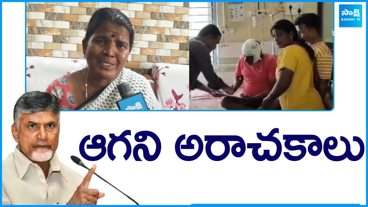 TDP Rowdies Attack on YSRCP Activists in AP | Chandrababu | YS Jagan |@SakshiTV
