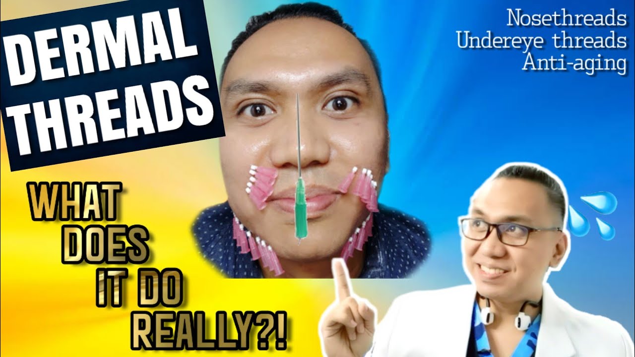 THREAD LIFTING  What it does really