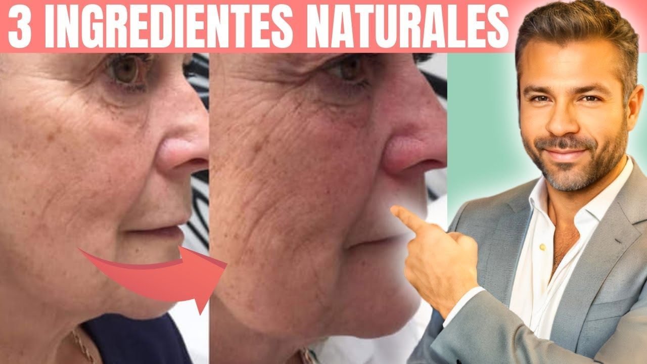 Botox Natural Sin Agujas: Rejuvenece y Quita Arrugas ¡Sorprendente Resultado! 