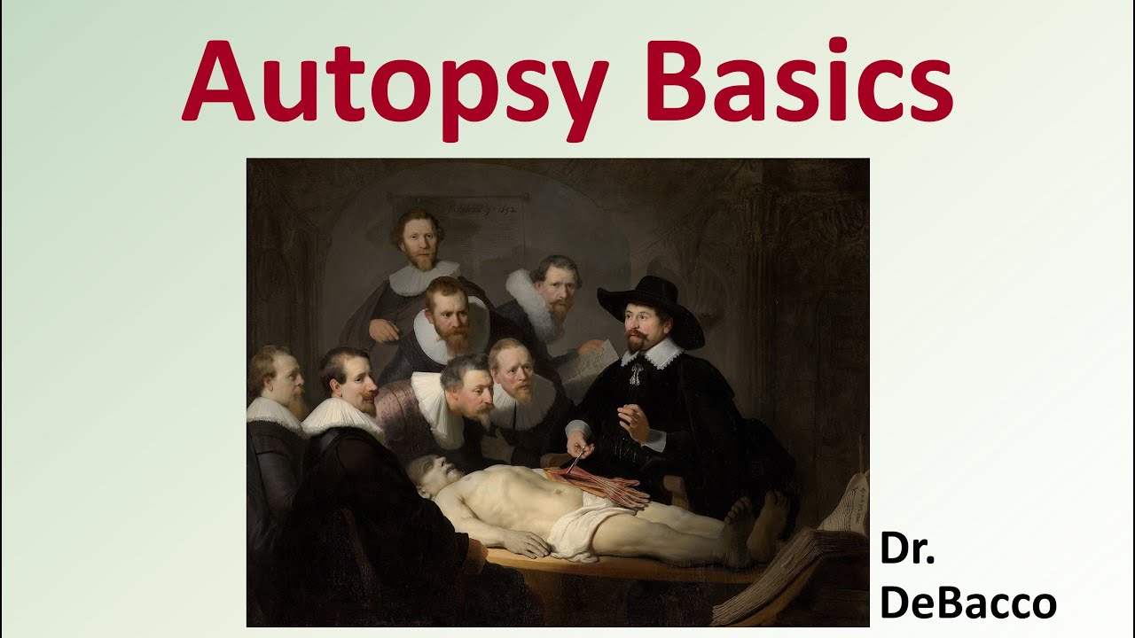 Autopsy Basics