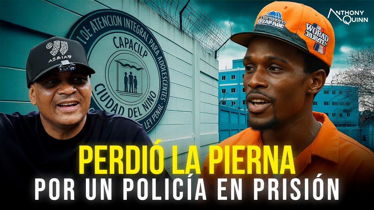 “Perdió una Pierna en Prisión Tras Ser Atacado por un Policía”