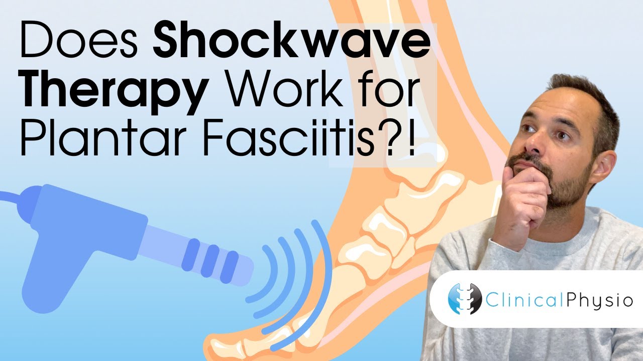Does Shockwave Therapy Work for Plantar Fasciitis?! | Expert Physio Explains the Research!