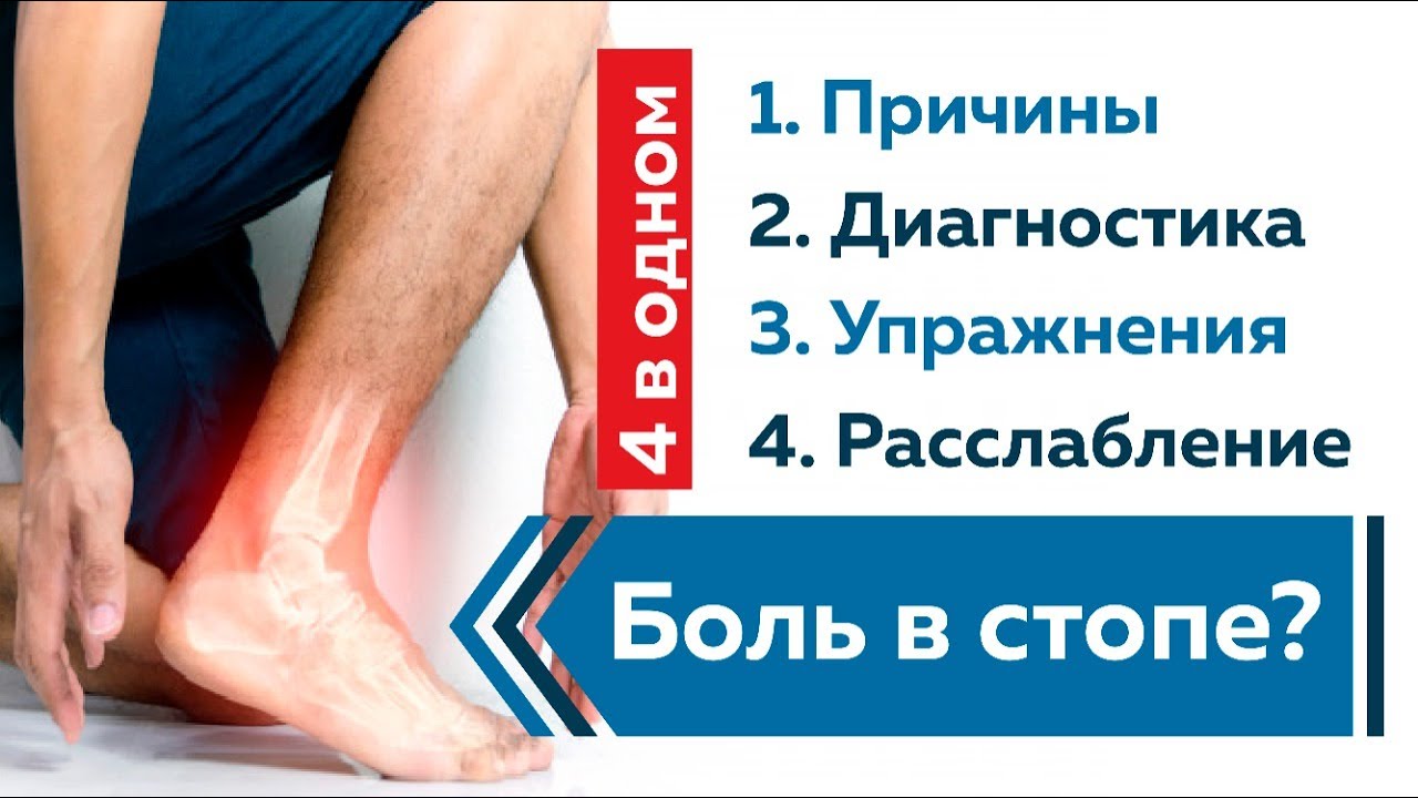 Боли в стопе от функционального плоскостопия? Диагностика и лечение.