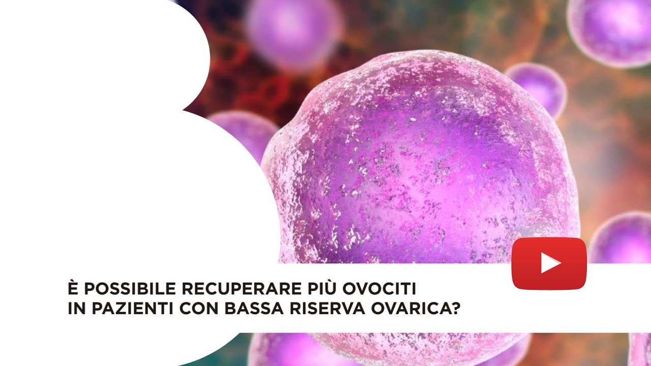 Doppia stimolazione per pazienti con bassa risposta ovarica