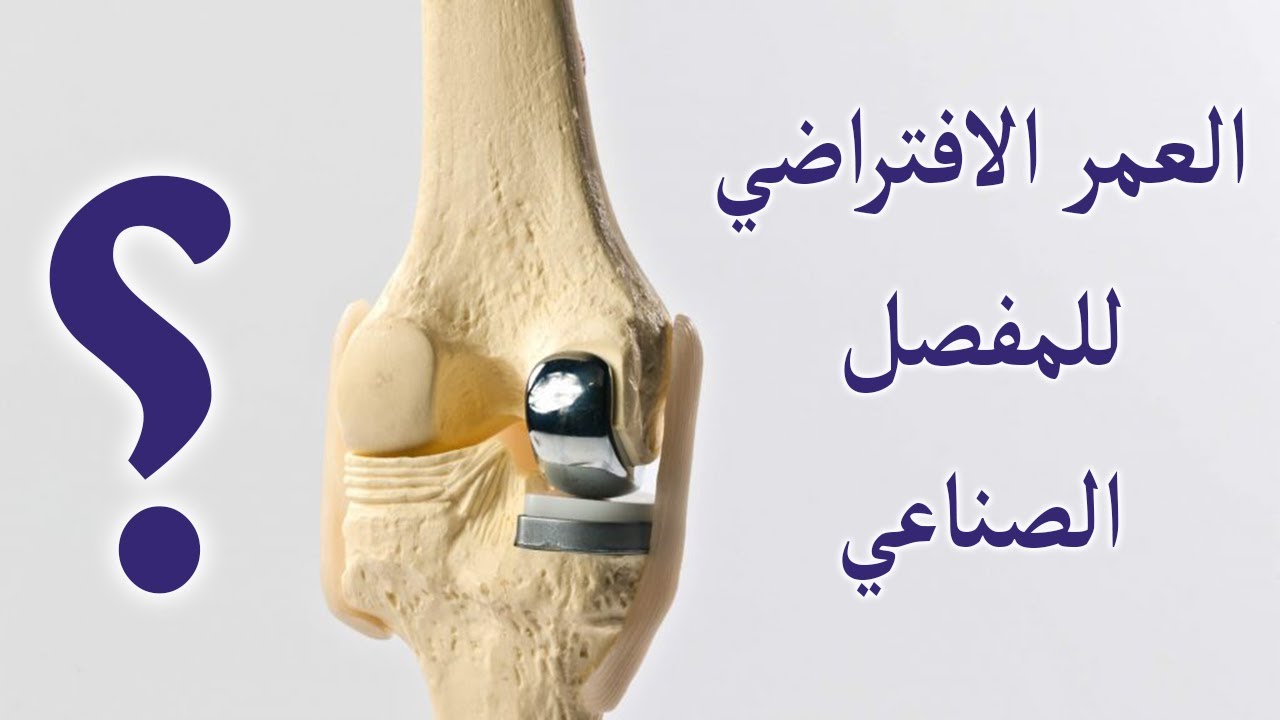 العمر الافتراضي للمفصل الصناعي