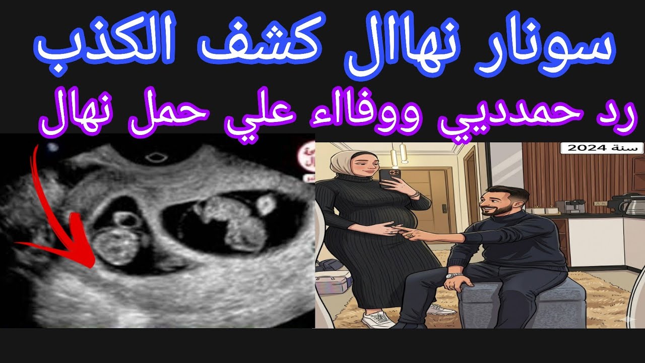  تسريب سونار نهاال كشف كذبة  الحمل 🤔رد حمدديي ووفااء علي حمل نهاال🤰اهل آالاء متعزموش 