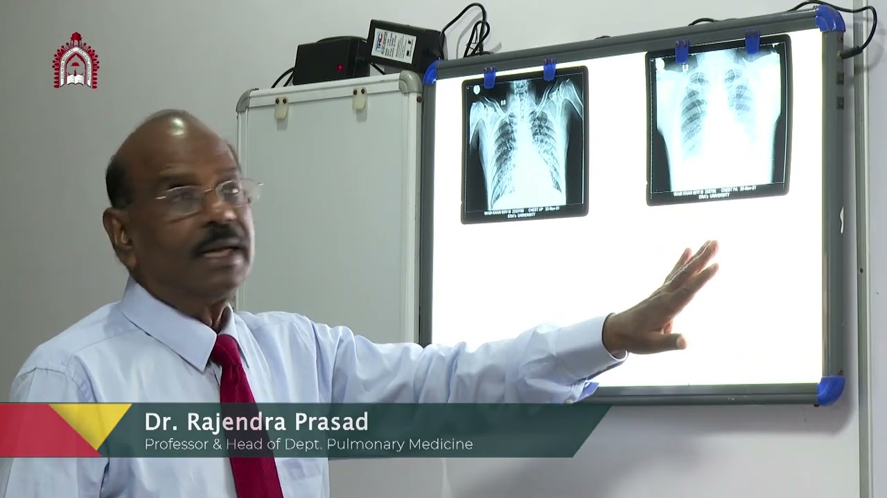Chest X Ray interpretation for U.G. Students in Hindi