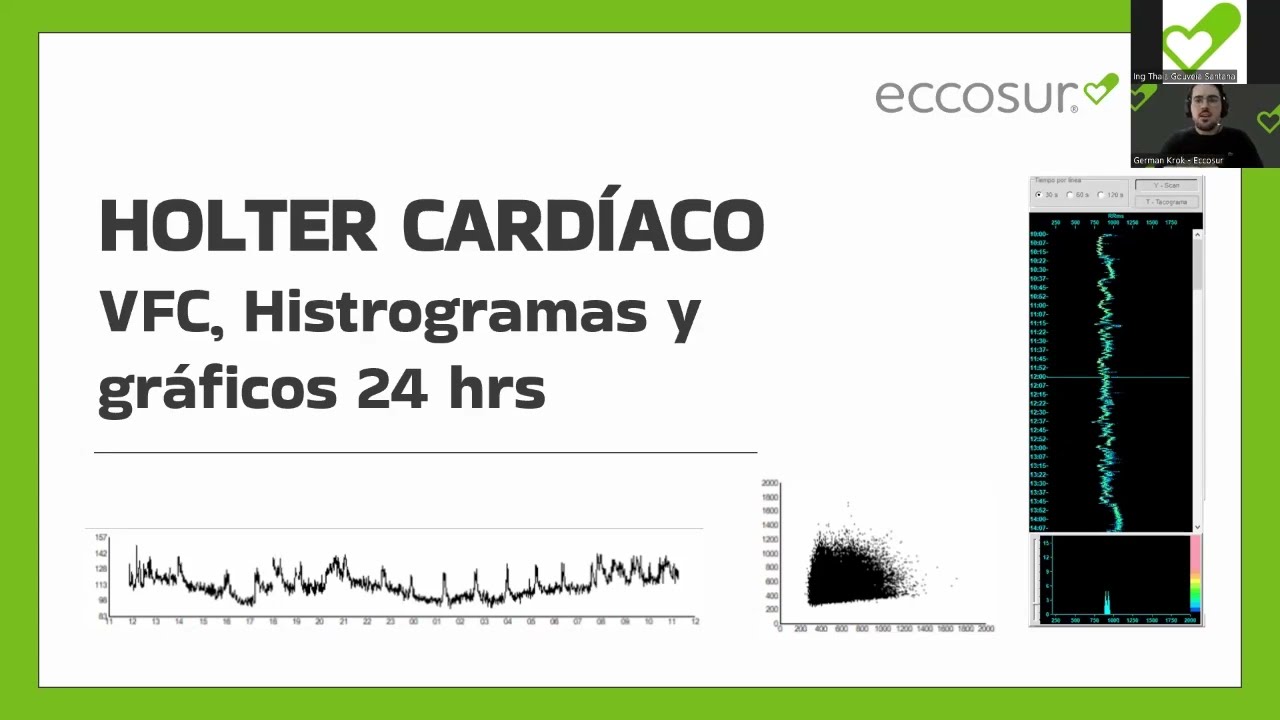 Taller Práctico Holter Cardiaco 28/08/2024 | ECCOSUR