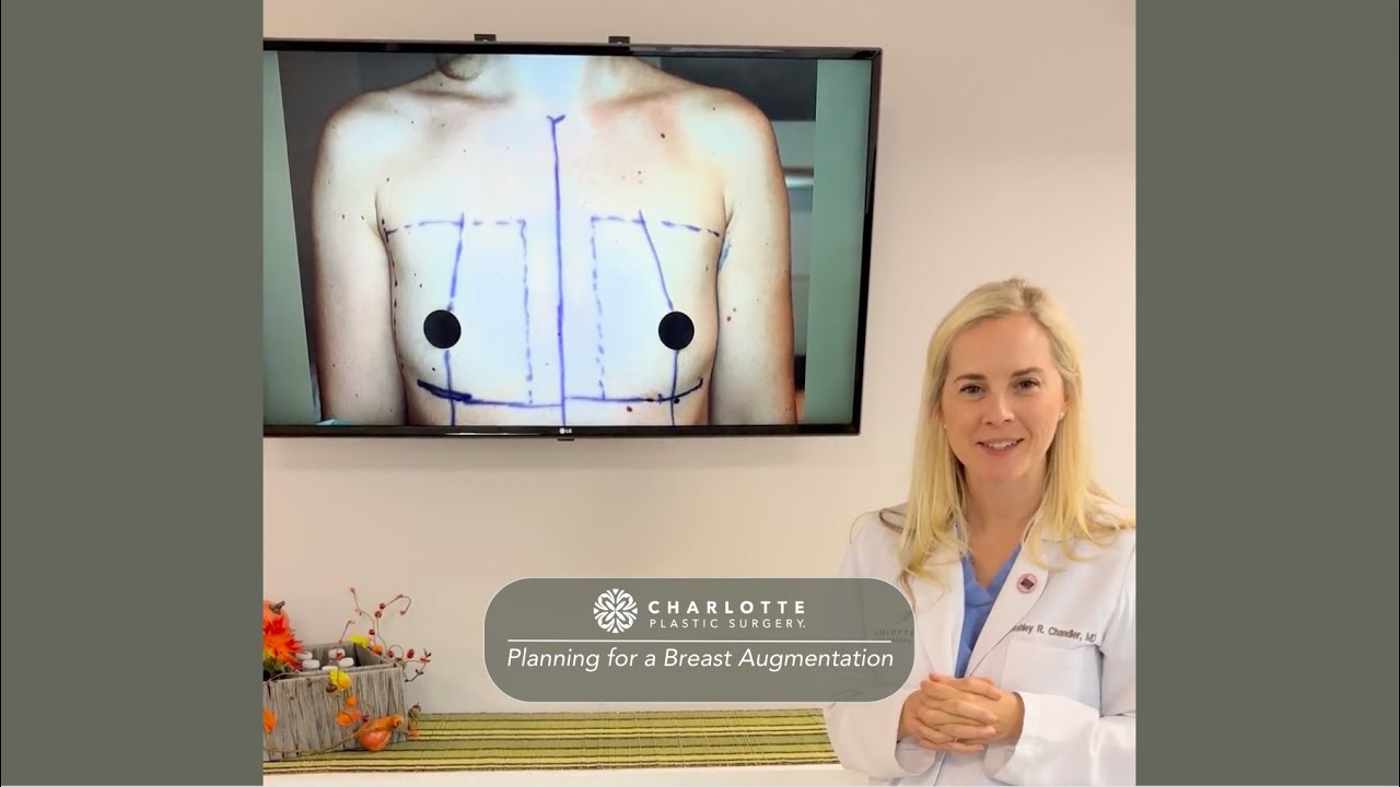 Planning for a Breast Augmentation with Dr. Ashley R Chandler