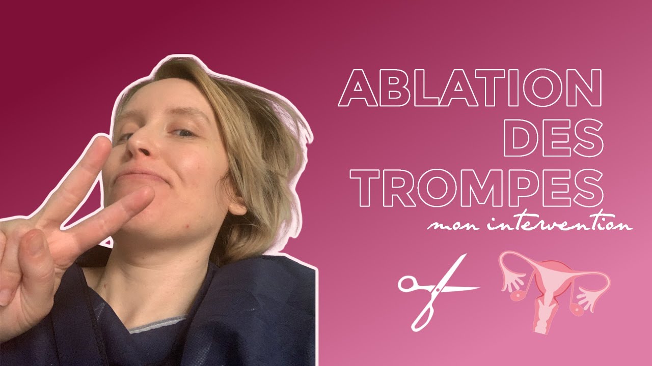 Ablation des trompes : mon intervention