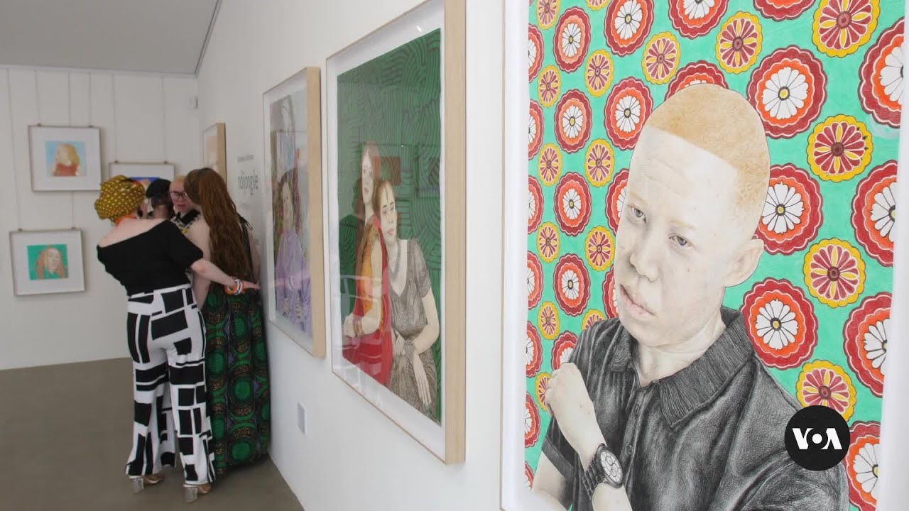 South African artists, influencers with albinism fight stigma | VOA News