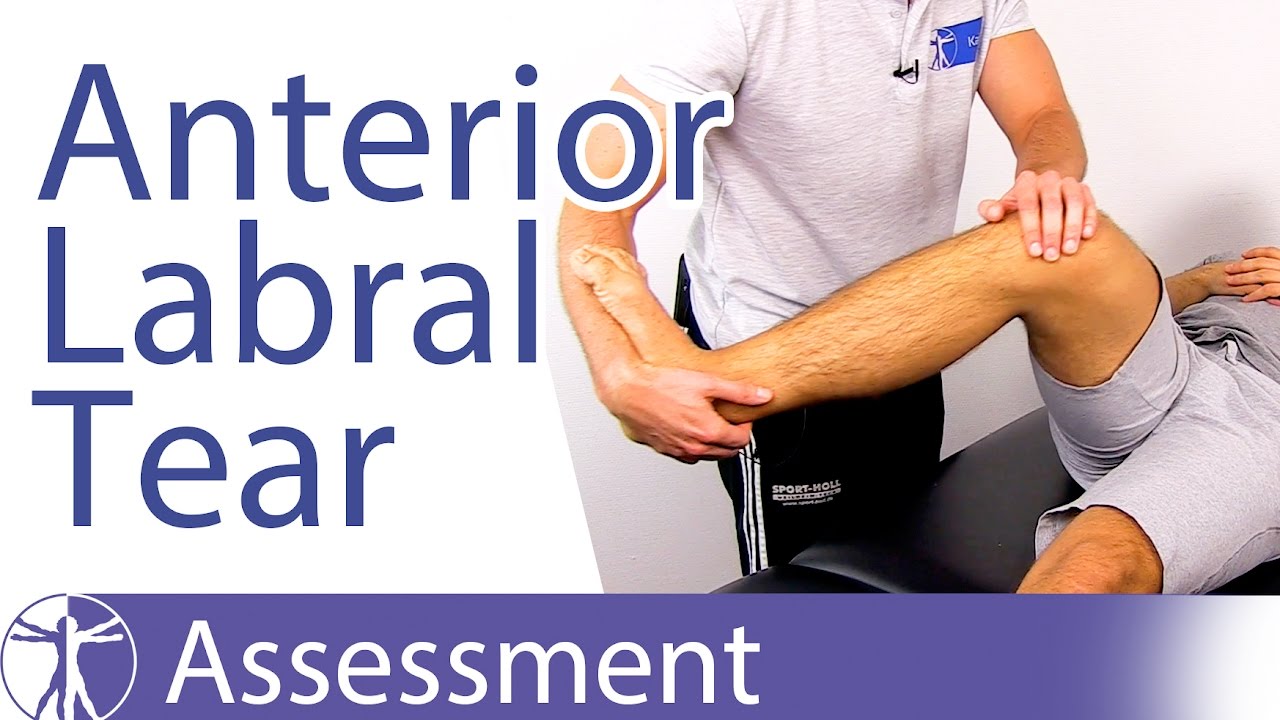 Anterior Labral Tear Test⎟Labral Tear