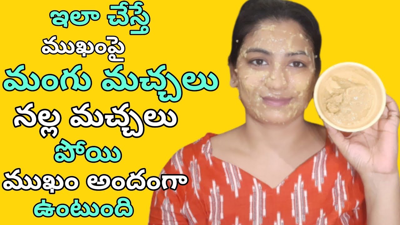 మంగు మచ్చలు సులువుగా పోగొట్టుకోండి/How To Remove Skin Pigmentation in Telugu/Get Rid Of Pigmentation