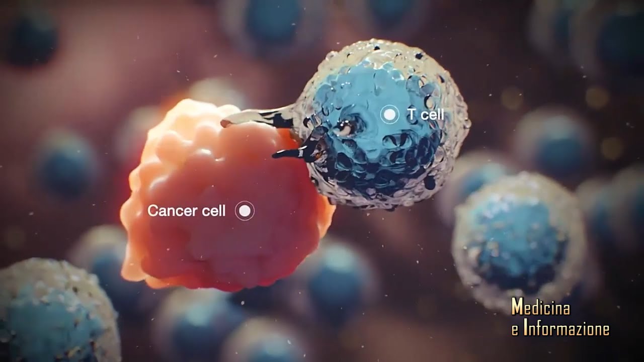 Prof. Gasbarrini - Microbiota e Cancro: le nuove scoperte per migliorare la risposta alle terapie