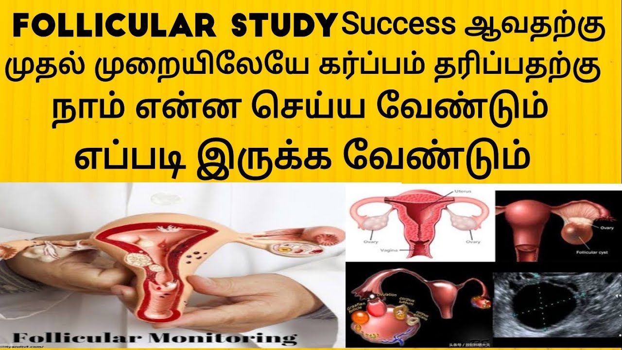 Follicular Study முதல்முறையிலேயே Success ஆவதற்கு என்ன செய்ய வேண்டும்| What to Do in Follicular study
