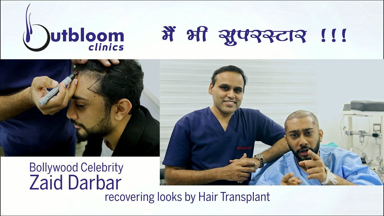hair transplant in india/ zaid darbar/best hair transplant/ hairline transplant