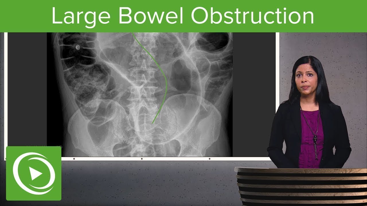 What Causes Large Bowel Obstruction? 🔍🩻