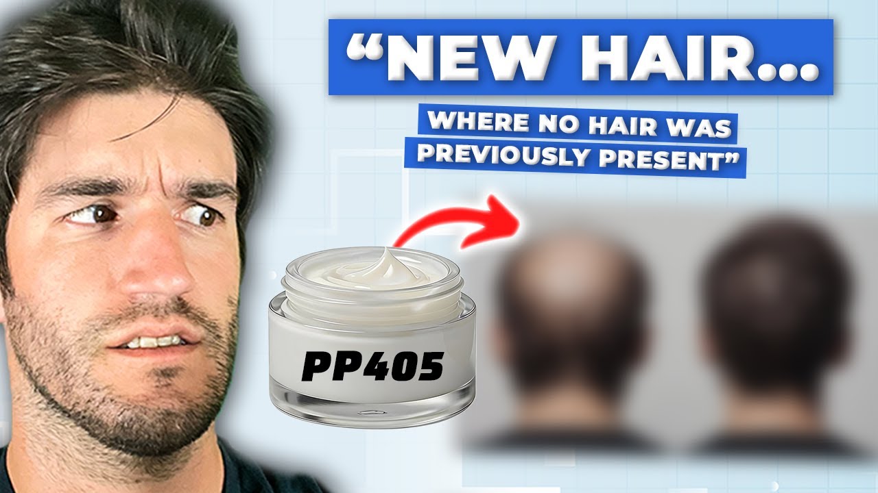 PP405: Regrows Hair In 8 Weeks. Is This The Miracle Cure?