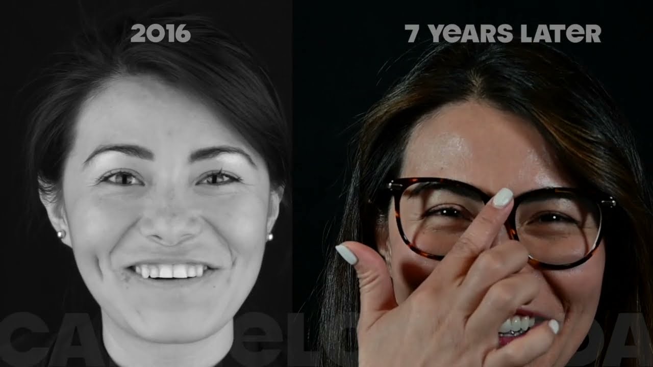 From Flowable Injection Technique to Feldspathic Ceramic Veneers