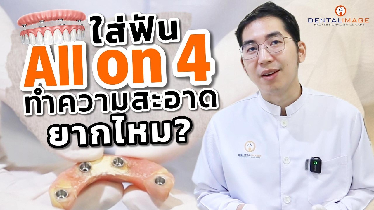 ใส่ฟัน All on 4 ทำความสะอาดยากไหม? #ทำฟันมาตรฐานสากล #allon4  #รากเทียม #ปัญหาฟัน #DentalImage