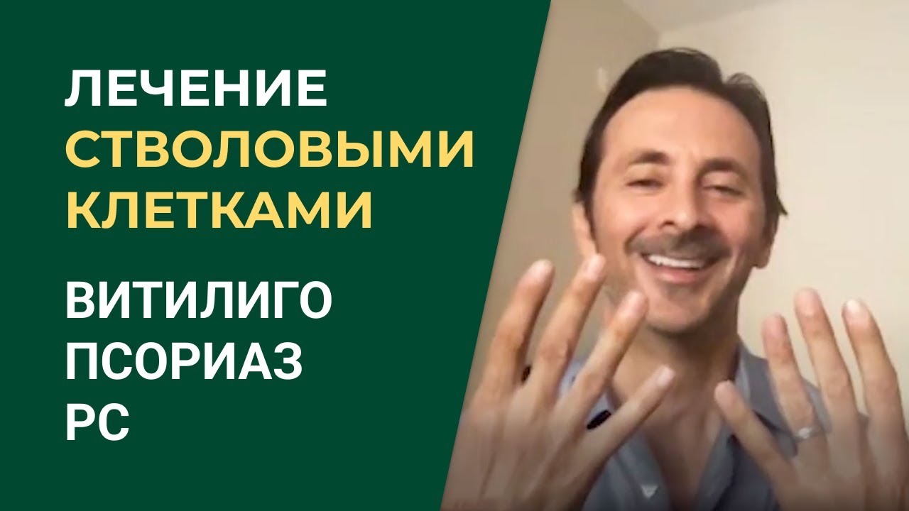 Стволовые клетки: Победа над Витилиго и еще 3 аутоимунными заболеваниями