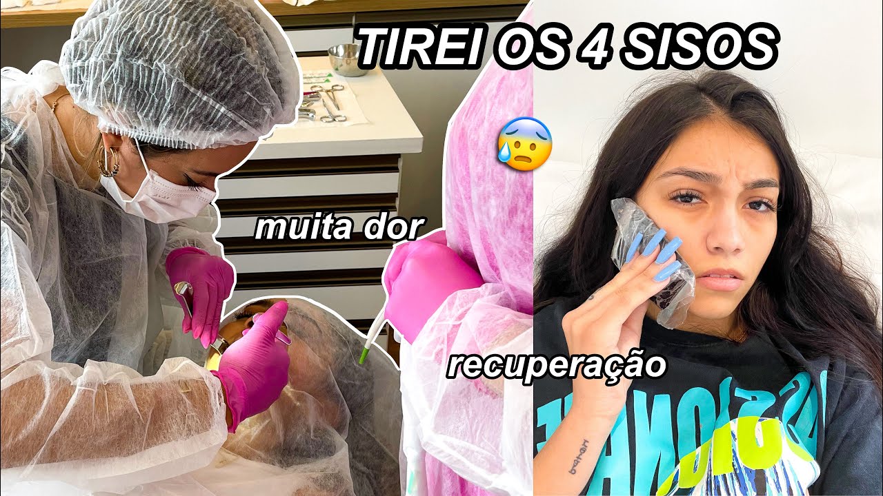 FIZ UMA CIRURGIA!! tirei os 4 sisos de uma vez