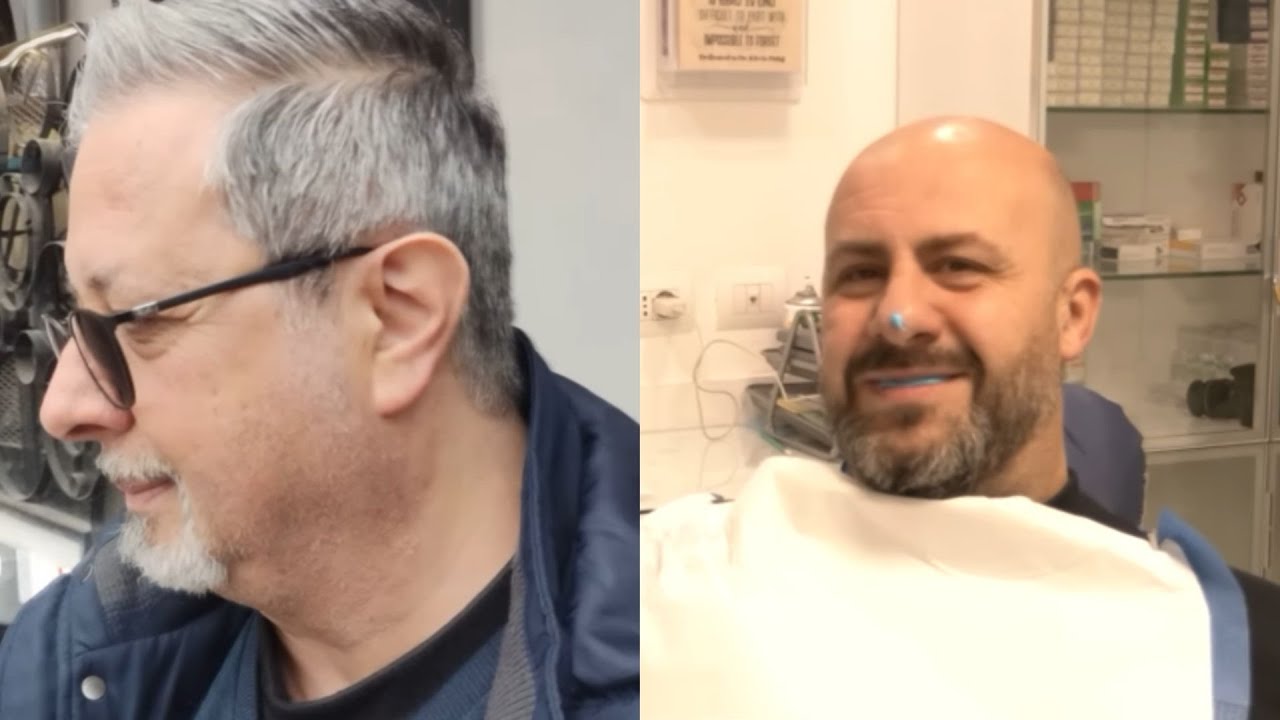 Cure dentali in Albania, Antonio monta i definitivi. Nuovo look per Tino: 