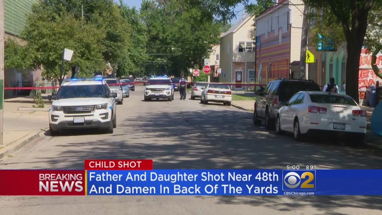 Toddler, Adult Shot In Back Of The Yards