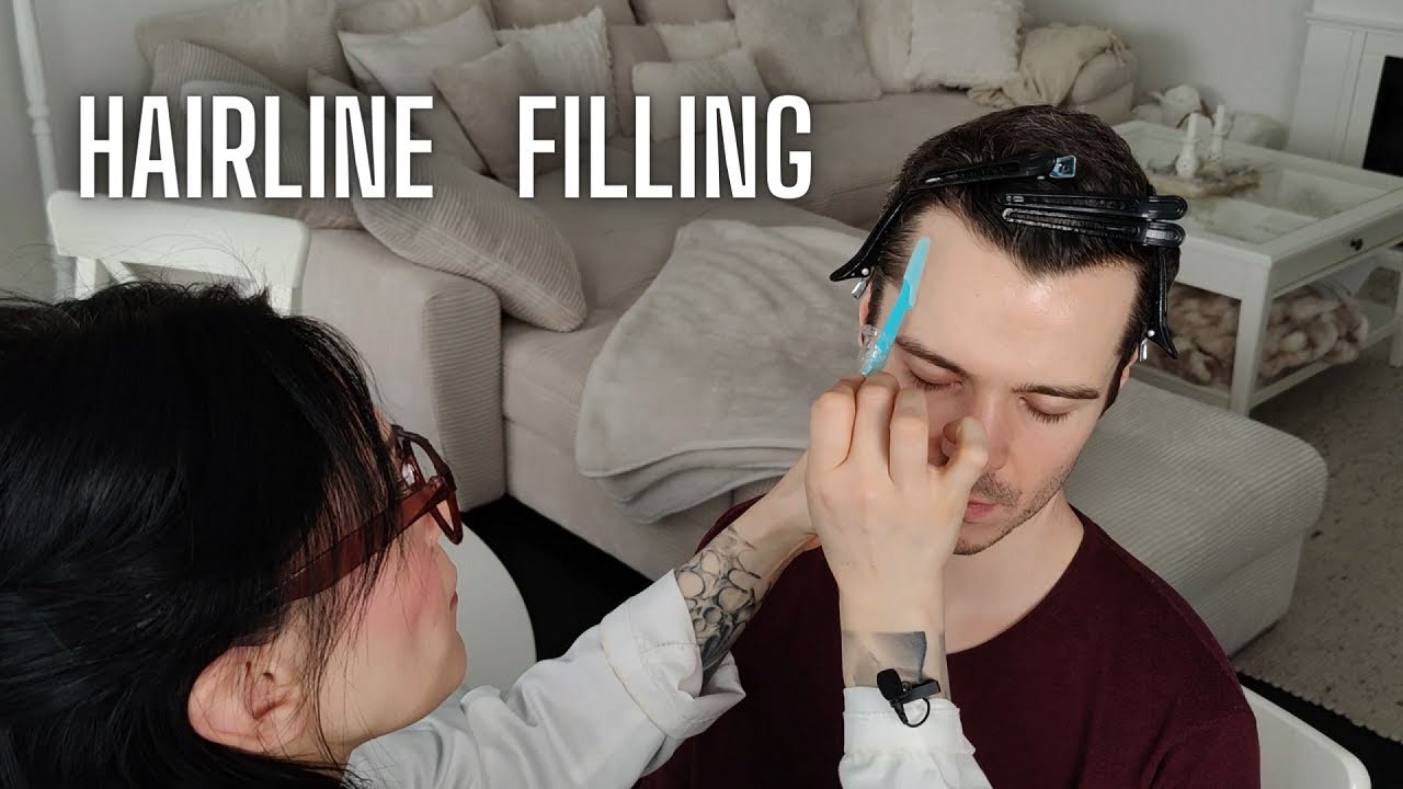 ASMR Full Process Of Hairline Examination & Filling