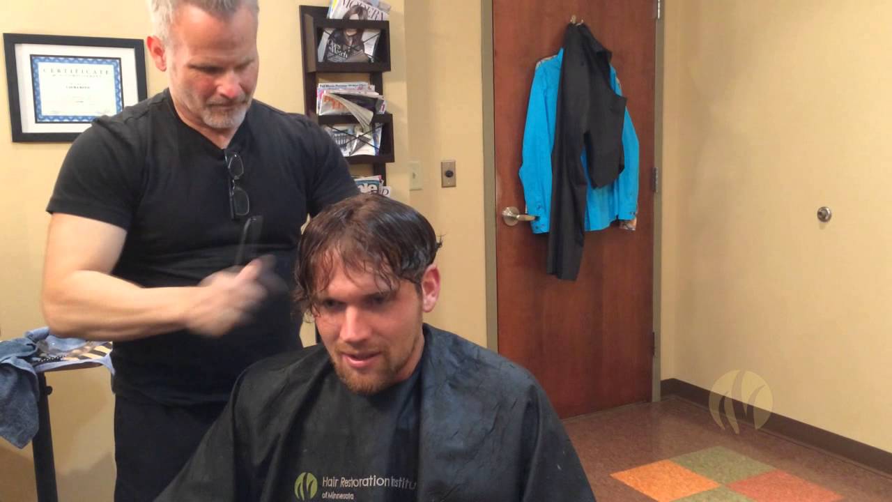 Andrew's Hair Replacement - Not GrandDad's Bad Toupee