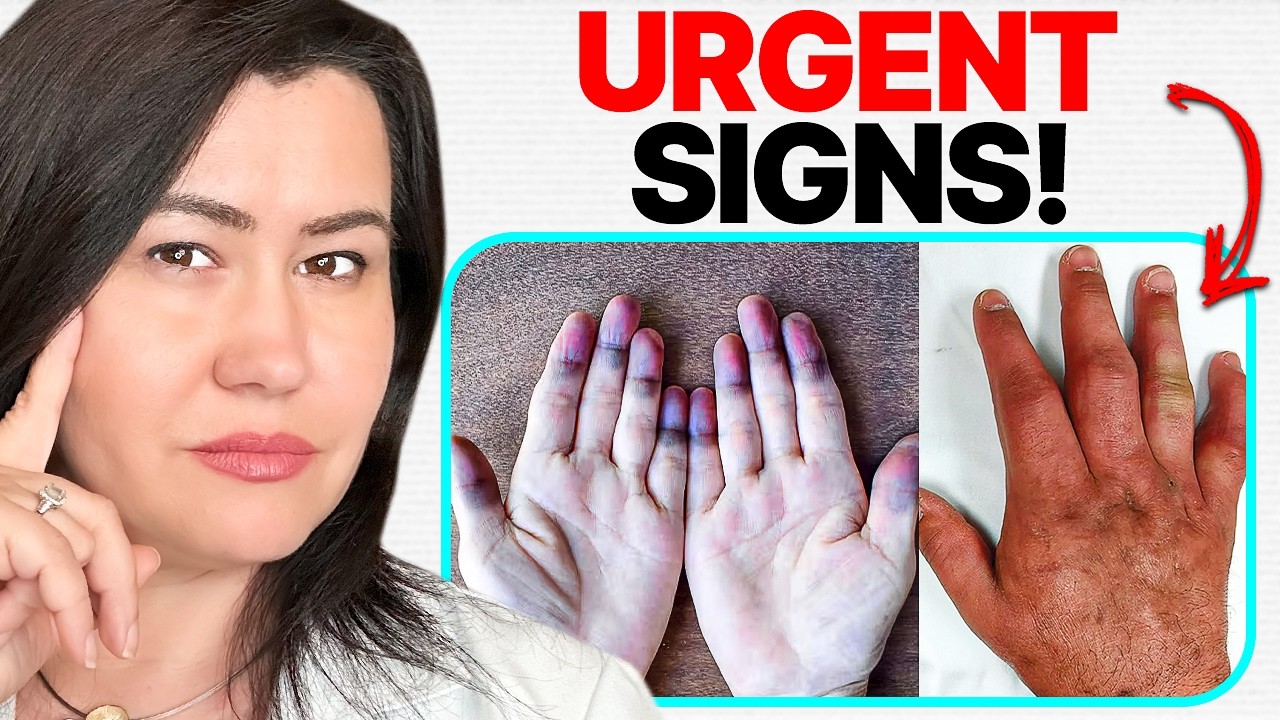 10 URGENT SIGNS of Mixed Connective Tissue Disease (MCTD)
